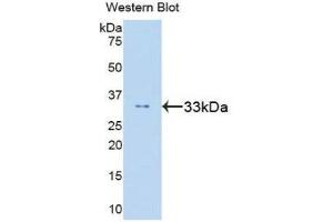 Western Blotting (WB) image for anti-Signal Transducer and Activator of Transcription 6, Interleukin-4 Induced (STAT6) (AA 262-520) antibody (ABIN1860655) (STAT6 anticorps  (AA 262-520))