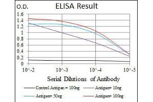 Black line: Control Antigen (100 ng), Purple line: Antigen(10 ng), Blue line: Antigen (50 ng), Red line: Antigen (100 ng), (DLK1 anticorps)