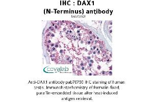 Image no. 1 for anti-Nuclear Receptor Subfamily 0, Group B, Member 1 (NR0B1) (N-Term) antibody (ABIN1733525)