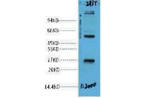 Western Blotting (WB) image for anti-EF-Hand Domain Family, Member D1 (EFHD1) antibody (ABIN3181263)