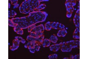 IF analysis of TFRC using anti-TFRC antibody (ABIN3043538). (Transferrin Receptor anticorps  (AA 1-198))