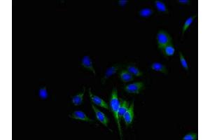 Immunofluorescent analysis of Hela cells using ABIN7149094 at dilution of 1:100 and Alexa Fluor 488-congugated AffiniPure Goat Anti-Rabbit IgG(H+L) (CYBB anticorps  (AA 283-570))