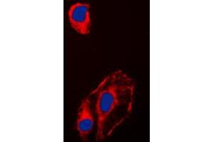 Immunofluorescent analysis of HSP90 beta (pS254) staining in HeLa cells. (HSP90AB1 anticorps  (pSer254))