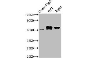 Immunoprecipitating GPT in Mouse liver tissue Lane 1: Rabbit control IgG instead of ABIN7143616 in Mouse liver tissue.
