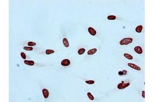 Immunocytochemistry analysis of ABIN7127266 diluted at 1:100 and staining in Hela cells performed on a Leica BondTM system.