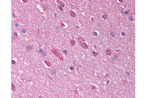 Anti-GABRQ antibody IHC of human brain, cortex. (GABRQ anticorps  (AA 31-80))