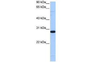 C1orf83 antibody used at 5 ug/ml to detect target protein.