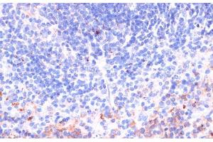 Immunohistochemistry of paraffin-embedded Mouse spleen using Perforin Polyclonal Antibody at dilution of 1:100 (40x lens).