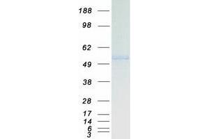 Validation with Western Blot