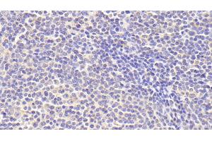 Detection of zAP70 in Human Lymph node Tissue using Polyclonal Antibody to Zeta Chain Associated Protein Kinase 70 kDa (zAP70)