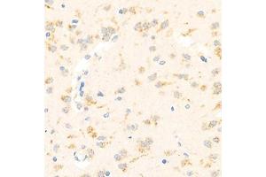 Immunohistochemistry analysis of paraffin-embedded rat brain using,Arp2 (ABIN7072895) at dilution of 1: 1500