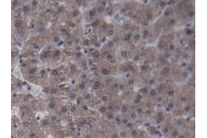 DAB staining on IHC-P; Samples: Porcine Liver Tissue (CRP anticorps  (AA 20-222))