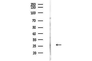 Western blot analysis of lysates from COLO205 cells(UV,30 min treatment), using WISP2 Antibody at 1/1000 dilution.