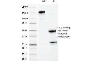 SDS-PAGE Analysis Purified MYDAM Monoclonal Antibody (MYADM/972).