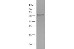 Western Blotting (WB) image for Eukaryotic Translation Initiation Factor 2-alpha Kinase 1 (EIF2AK1) (AA 1-194) protein (His-IF2DI Tag) (ABIN7122838)