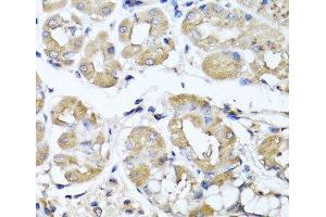 Immunohistochemistry of paraffin-embedded Human stomach using IFNL1 Polyclonal Antibody at dilution of 1:100 (40x lens). (IL29 anticorps)