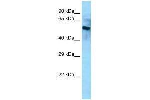 Western Blotting (WB) image for anti-beta-Carotene Oxygenase 2 (BCO2) (Middle Region) antibody (ABIN2788504) (BCO2 anticorps  (Middle Region))