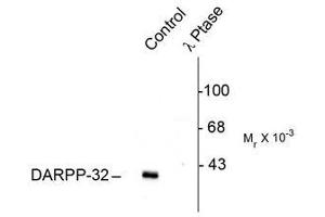 Image no. 1 for anti-Protein Phosphatase 1, Regulatory (Inhibitor) Subunit 1B (PPP1R1B) (pThr75) antibody (ABIN372607)