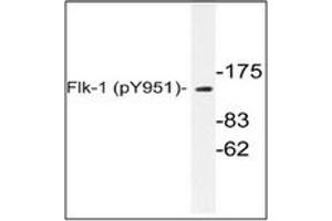 Image no. 1 for anti-VEGF Receptor 2 (VEGFR2) (pTyr951) antibody (ABIN318153) (VEGFR2/CD309 anticorps  (pTyr951))