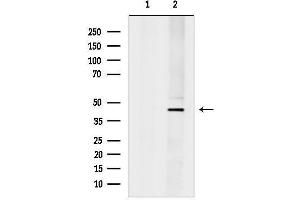 Western blot analysis of lysates from Hela cells, using SERPIN Antibody.