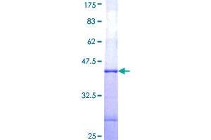 Image no. 1 for Guanylate Cyclase 2F, Retinal (GUCY2F) (AA 311-420) protein (GST tag) (ABIN1306224)