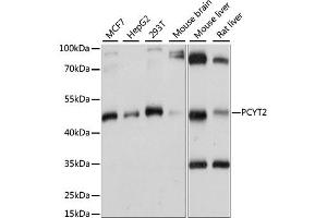 Western blot analysis of extracts of various cell lines, using PCYT2 antibody (ABIN6291655) at 1:1000 dilution.