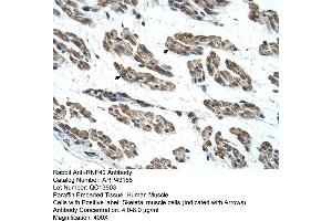Human Muscle (RNF40 anticorps  (C-Term))