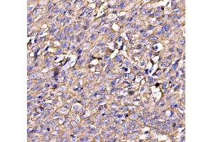 IHC analysis of Drebrin/DBN1 using anti-Drebrin/DBN1 antibody (ABIN7602638). (DBN1 anticorps  (AA 9-649))
