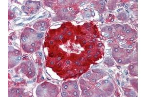 Pancreas, Human: Formalin-Fixed, Paraffin-Embedded (FFPE)