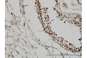 Image no. 7 for anti-Tripartite Motif Containing 33 (TRIM33) (AA 1006-1106) antibody (ABIN599250) (TRIM33 anticorps  (AA 1006-1106))