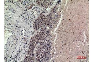 Immunohistochemistry (IHC) analysis of paraffin-embedded Human Lung, antibody was diluted at 1:100. (FGF16 anticorps  (Internal Region))