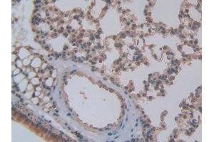Detection of CXCL7 in Mouse Lung Tissue using Polyclonal Antibody to Chemokine (C-X-C motif) ligand 7 ( CXCL7) (CXCL7 anticorps  (AA 40-113))