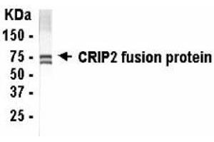 Western Blotting (WB) image for anti-Cysteine-Rich Protein 2 (CRIP2) (AA 1-208) antibody (ABIN2467798) (CRIP2 anticorps  (AA 1-208))