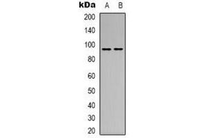 Western blot analysis of CD100 expression in MCF7 (A), L929 (B) whole cell lysates. (SEMA4D/CD100 anticorps  (N-Term))