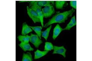 Immunofluorescence (IF) image for anti-Hexokinase 1 (HK1) (AA 1-917), (N-Term) antibody (ABIN317095) (Hexokinase 1 anticorps  (N-Term))