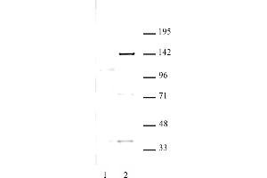 KDM4C antibody (pAb) tested by Western blot. (KDM4C anticorps)