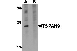 Western Blotting (WB) image for anti-Tetraspanin 9 (TSPAN9) (Middle Region) antibody (ABIN1031151) (Tetraspanin 9 anticorps  (Middle Region))