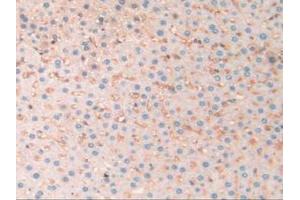 IHC-P analysis of Rat Liver Tissue, with DAB staining. (SERPINA10 anticorps  (AA 278-425))