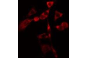 ABIN6275806 staining  Hela cells by IF/ICC. (CYP1B1 anticorps  (Internal Region))