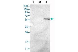Western Blot analysis of Lane 1: RT-4 cell, Lane 2: U-251 MG sp cell and Lane 3: human plasma tissue (IgG/HSA depleted) lysates with ZMPSTE24 polyclonal antibody . (ZMPSTE24 anticorps)