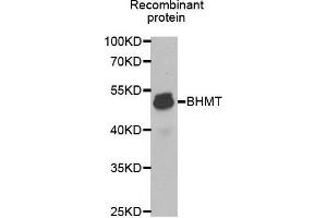 Western blot analysis of extracts of Recombinant protein cell lines, using BHMT antibody. (BHMT anticorps  (AA 177-406))