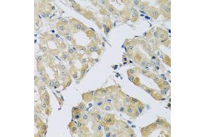 Immunohistochemistry of paraffin-embedded human stomach using ABCF2 antibody.