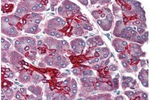 Human Pancreas (formalin-fixed, paraffin-embedded) stained with KRT19 antibody ABIN396942 at 10 ug/ml followed by biotinylated anti-mouse IgG secondary antibody ABIN481714, alkaline phosphatase-streptavidin and chromogen. (Cytokeratin 19 anticorps)