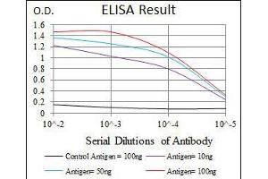 Black line: Control Antigen (100 ng), Purple line: Antigen(10 ng), Blue line: Antigen (50 ng), Red line: Antigen (100 ng), (PDX1 anticorps)