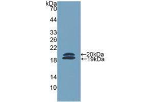 Western blot analysis of recombinant Mouse FCN2. (Ficolin 2 anticorps  (AA 97-254))