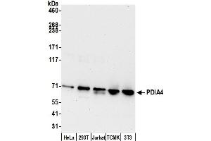 Western Blotting (WB) image for anti-Protein Disulfide Isomerase Family A, Member 4 (PDIA4) (AA 595-645) antibody (ABIN7453003)