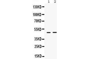 Western Blotting (WB) image for anti-Inhibitor of Growth Family, Member 1 (ING1) (AA 192-223), (Middle Region) antibody (ABIN3042467) (ING1 anticorps  (Middle Region))
