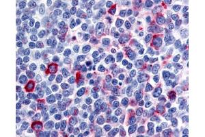 Anti-CCR8 antibody IHC of human tonsil, germinal center. (CCR8 anticorps  (N-Term))