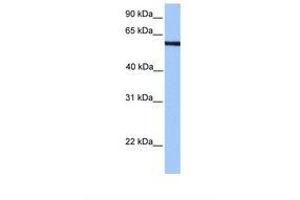 Image no. 1 for anti-Protein AF-9 (MLLT3) (N-Term) antibody (ABIN6737837)