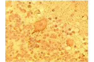 Immunohistochemical staining of normal human brain tissue using DEGS1 Antibody at 15 µg/ml. (DEGS1 anticorps)